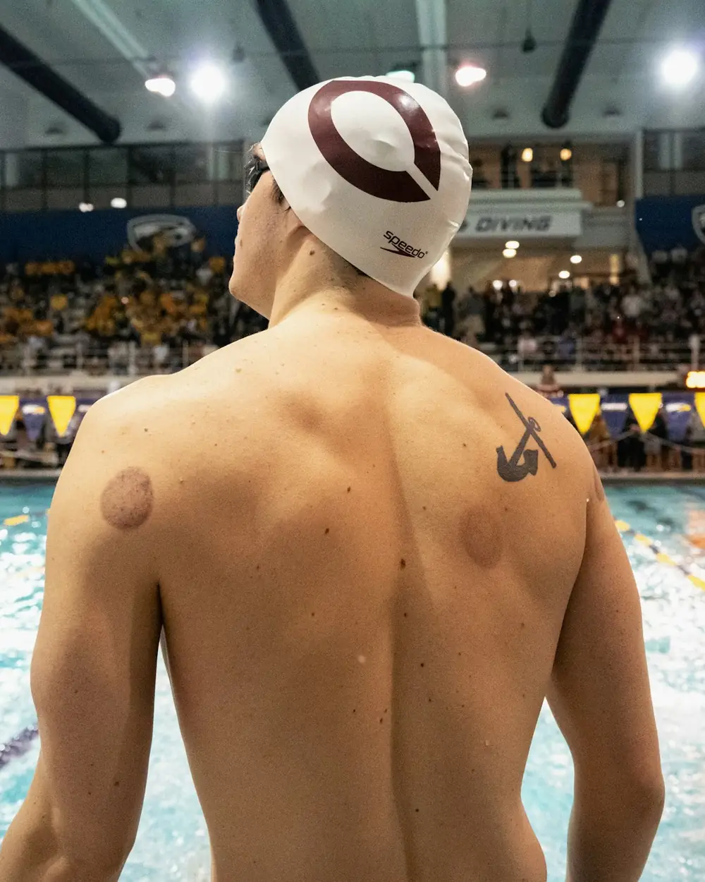 A swimmer at the poolside with round cupping marks on his back